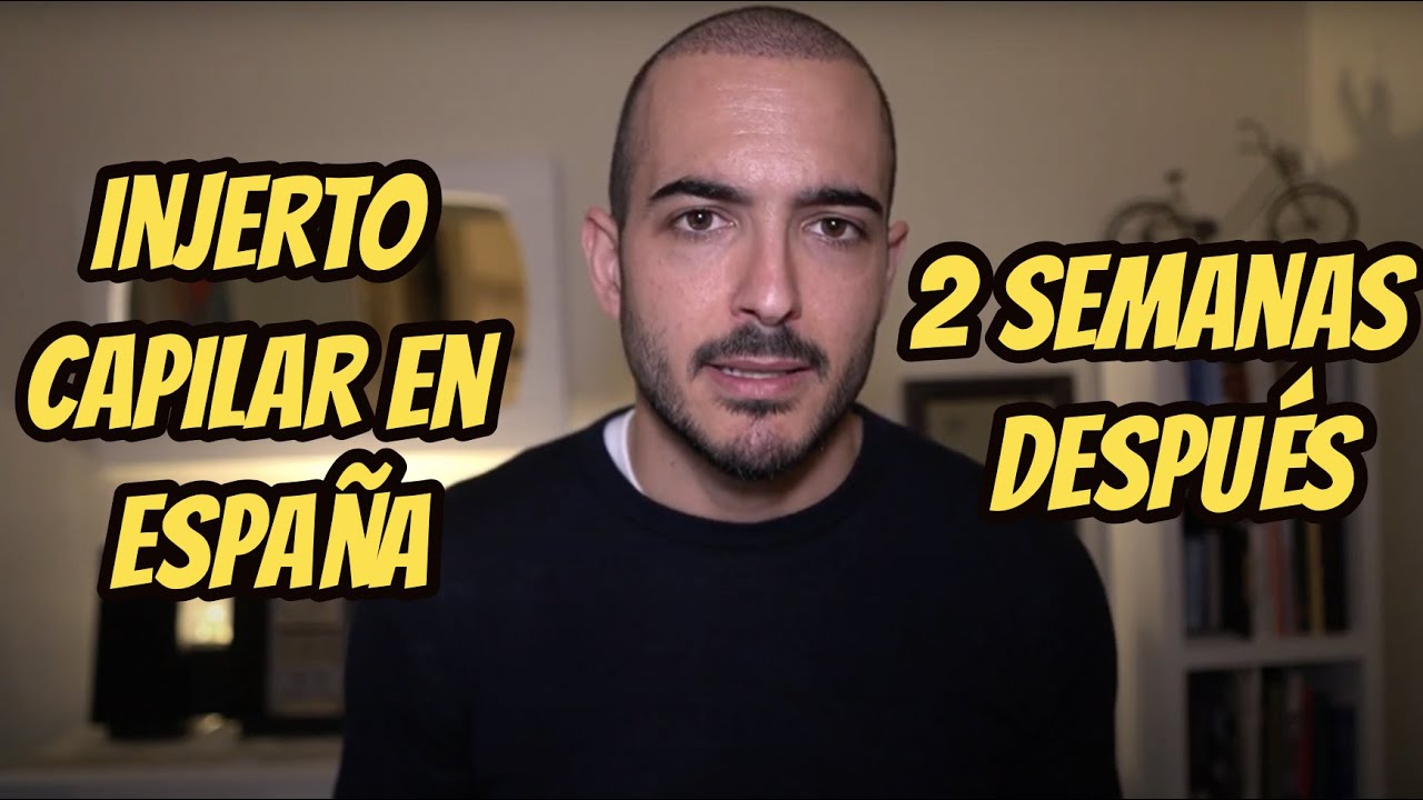 Trasplante capilar en España, dos semanas después