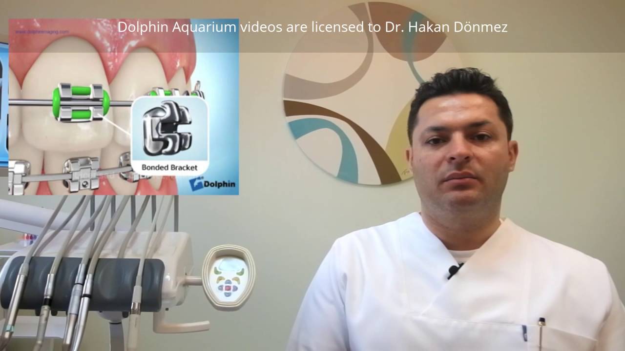 Ortodonti Tedavi Aşamaları - Dr. Hakan Dönmez