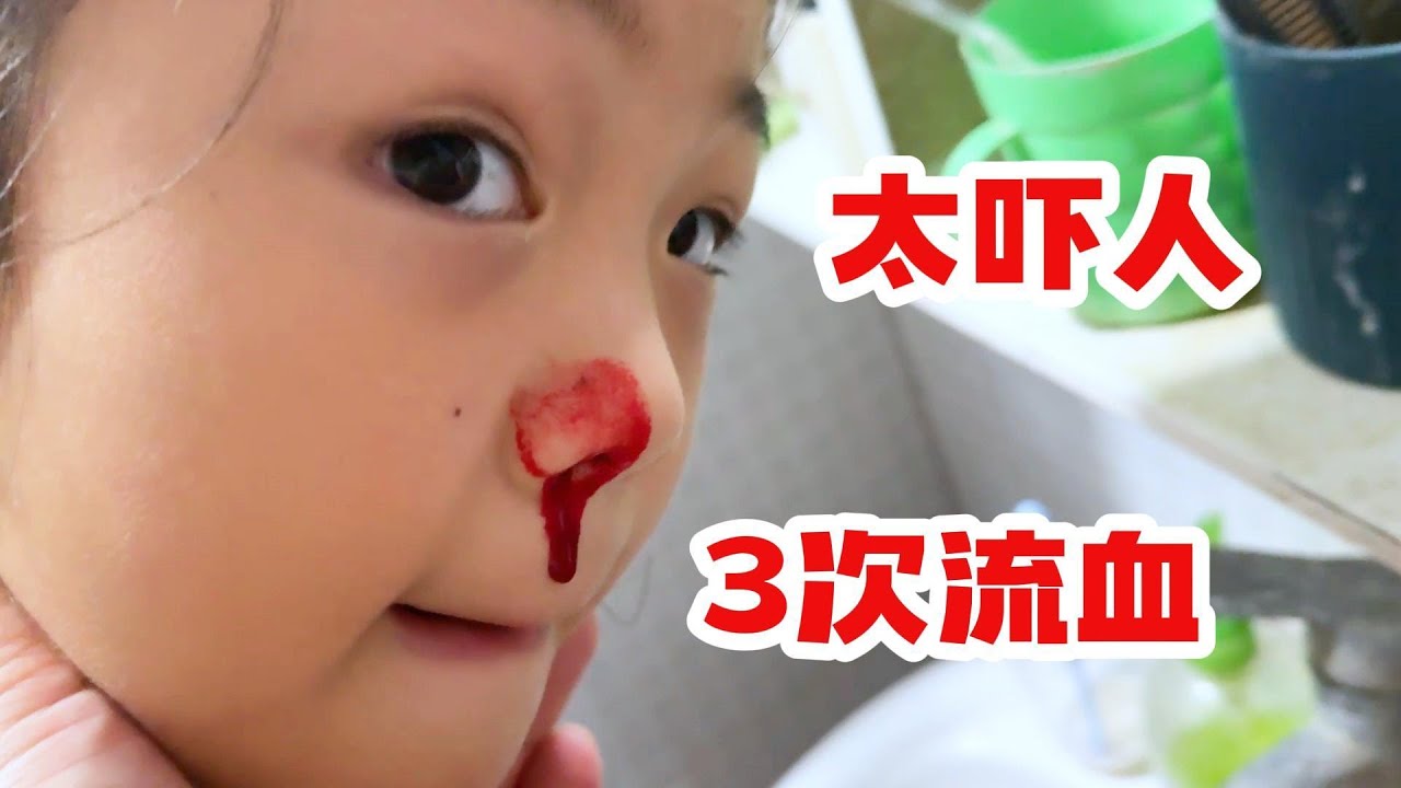 一个小时之内3次鼻血，这也太夸张了吧