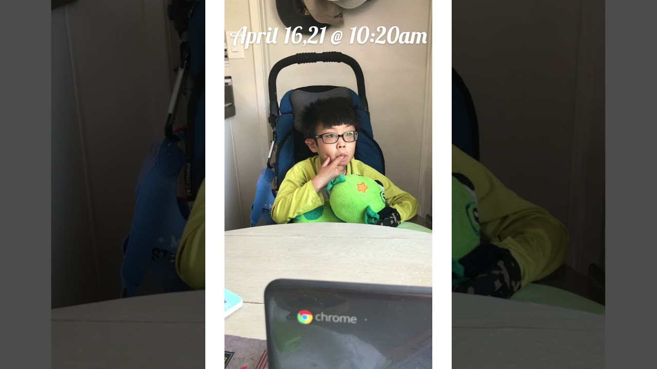 Dup15q seizures Mar-April 2021