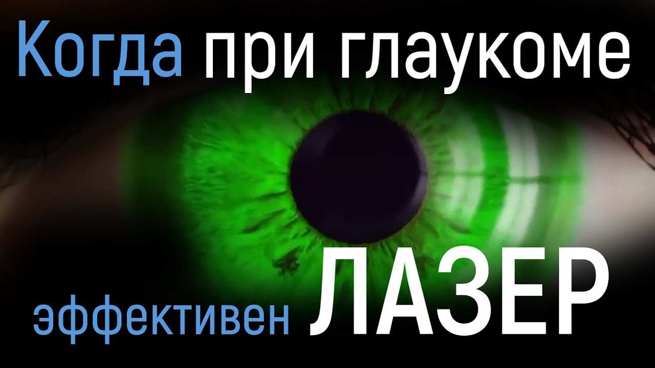 Когда при глаукоме эффективен лазер