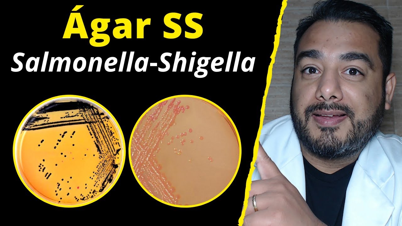 7) Ágar Salmonella Shigella (SS) | Meio de Cultura Seletivo | Concurso Público Microbiologia