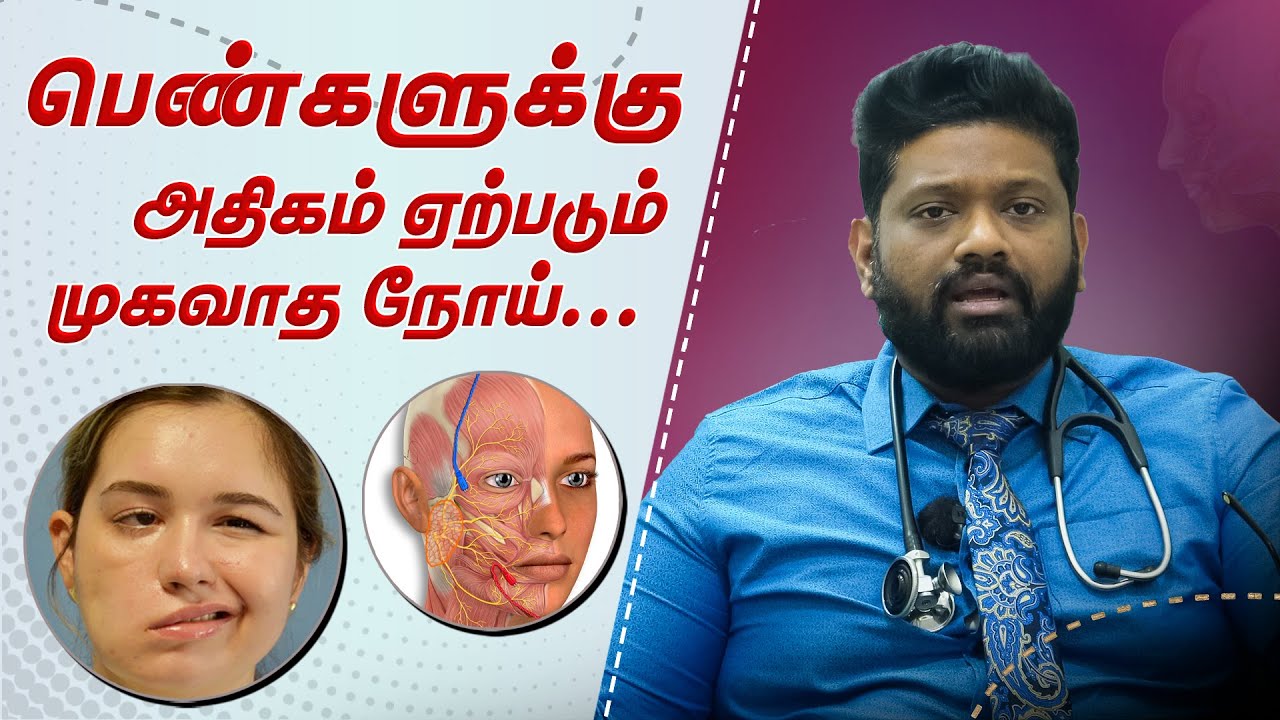 முகவாத பிரச்சனை மிக பெரிய ஆபத்தை ஏற்படுத்துமா? | Dr Sabarinath Ravichandar Explains