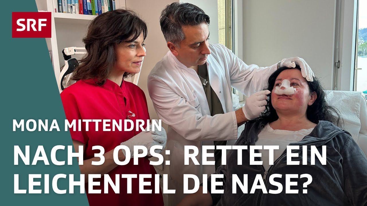 Botox, Brust-OP und Nasenkorrektur – Wie weit gehen wir für Schönheit? | Mona mittendrin 2024 | SRF