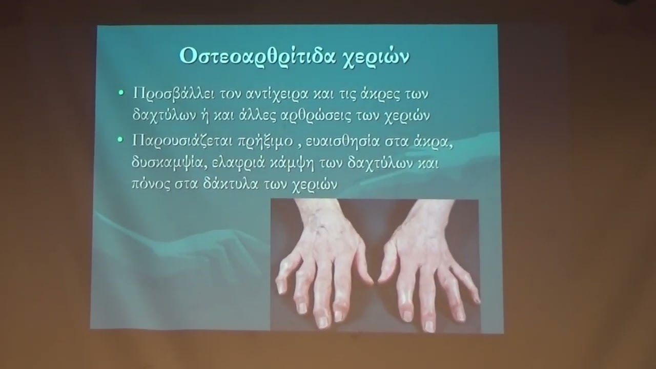 ΑΝΟΙΧΤΟ ΠΑΝΕΠΙΣΤΗΜΙΟ ΔΗΜΟΥ ΔΙΟΝΥΣΟΥ - ΟΣΤΕΟΑΡΘΡΙΤΙΔΑ & ΟΣΤΕΟΠΟΡΩΣΗ, ΔΥΟ ΕΠΙΔΗΜΙΕΣ ΤΗΣ ΕΠΟΧΗΣ ΜΑΣ