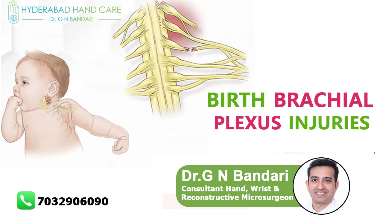 Birth Brachial Plexus Injuries || Dr GN Bandari | Hand ,Wrist & Micro-surgeon || Hyderabad Hand Care