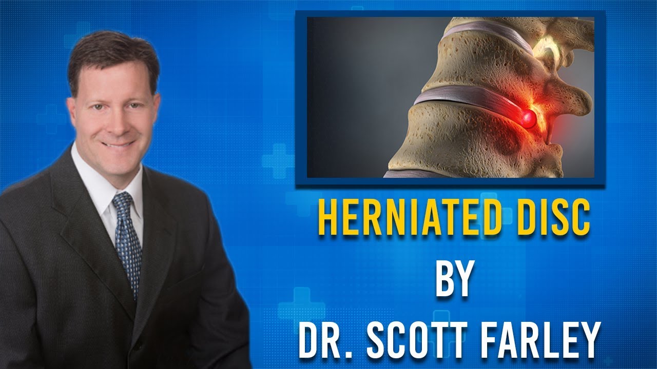 WAS MY DISC HERNIATED FROM AN ACCIDENT?