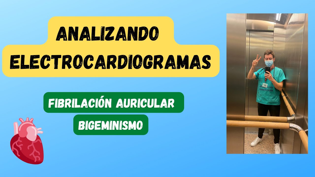APRENDIENDO ELECTROS 😎: Bigeminismo y FA