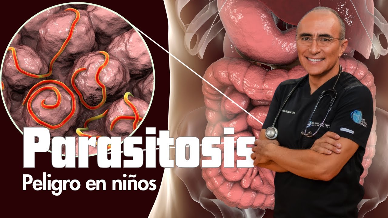 Parasitos Intestinales: Sintomas de parasitos en niños