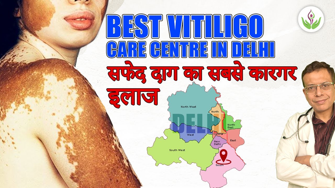 Best Vitiligo Care Centre Now in Delhi | सफेद दाग का सबसे कारगर इलाज | Care Well Medical Centre