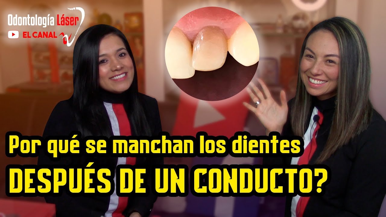 Por qué se manchan los dientes después de un conducto? - Odontología Láser