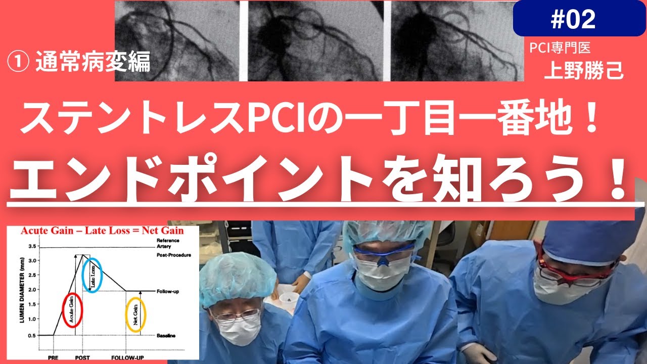 第2回 冠動脈インターベンションの一丁目一番地！ステントレスPCIのエンドポイントを知ろう！①通常病変編