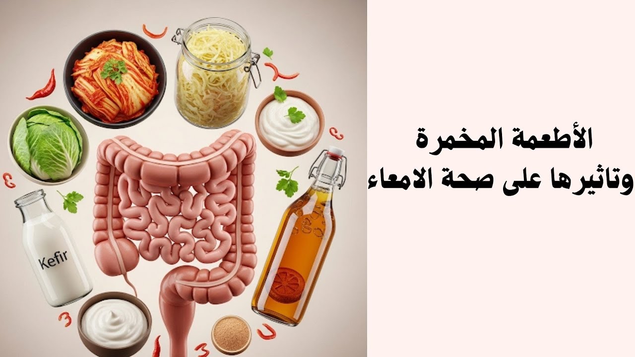 اﻷطعمة المخمرة وتاثيرها على الأمعاء