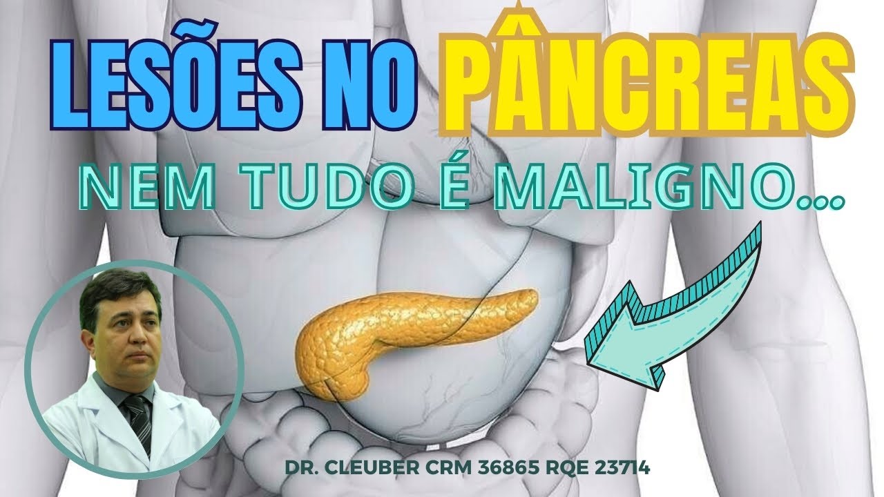 Lesão no Pâncreas: Doenças que podem Confundir o Diagnóstico.
