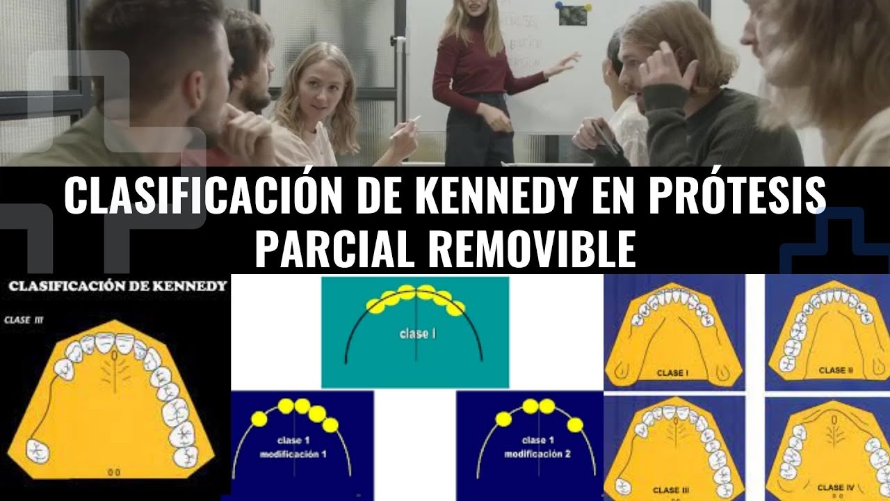 𝐂𝐋𝐀𝐒𝐈𝐅𝐈𝐂𝐀𝐂𝐈𝐎𝐍 𝐃𝐄 𝐊𝐄𝐍𝐍𝐄𝐃𝐘 𝐄𝐍 𝐏𝐑𝐎𝐓𝐄𝐒𝐈𝐒 𝐏𝐀𝐑𝐂𝐈𝐀𝐋 𝐑𝐄𝐌𝐎𝐕𝐈𝐁𝐋𝐄