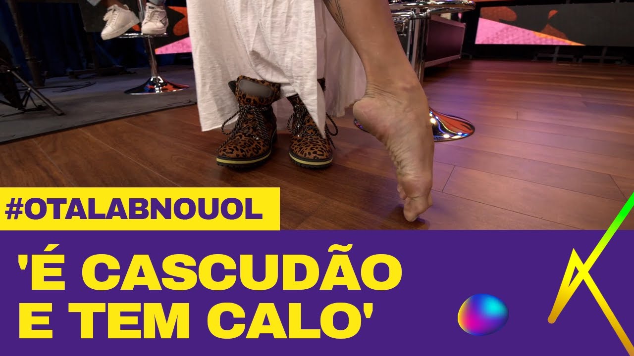 Aline Riscado mostra pé de bailarina: 'Sempre foi feio e muito zoado'