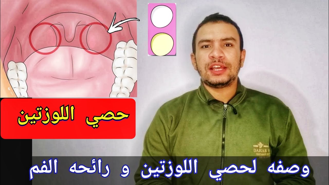 اسرع وصفه للتخلص من حصي اللوزتين و رائحه الفم الكريهه