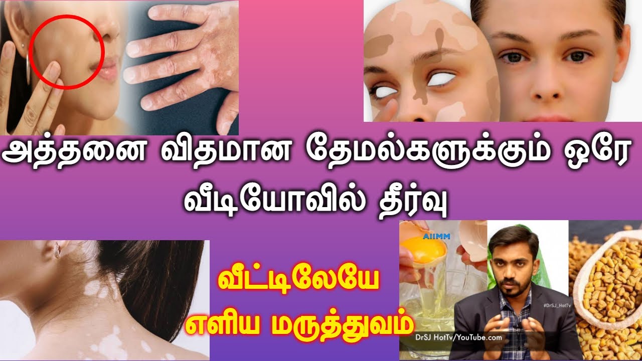 தேமல் மறைந்து தேகம் மிளிர இயற்க்கை வீட்டு மருத்துவம் | CLEAR WHITE SPOTS NATURALLY | DrSJ