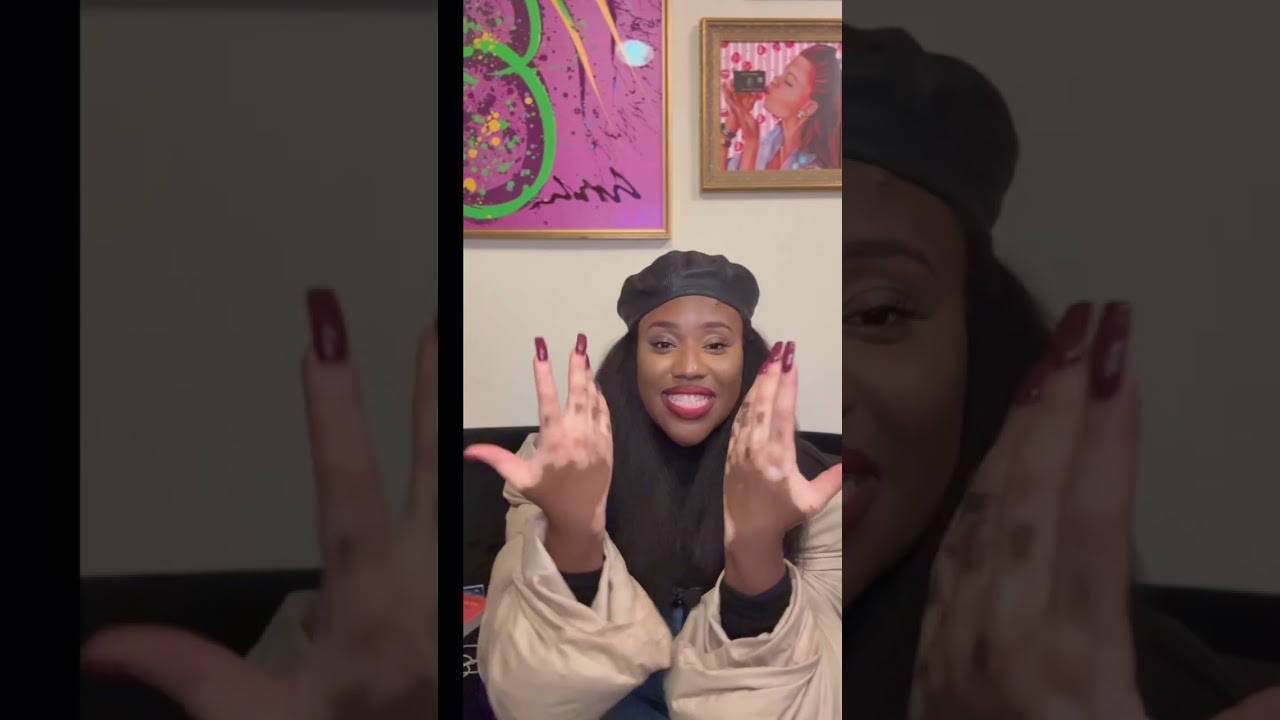 Where is my vitiligo ?