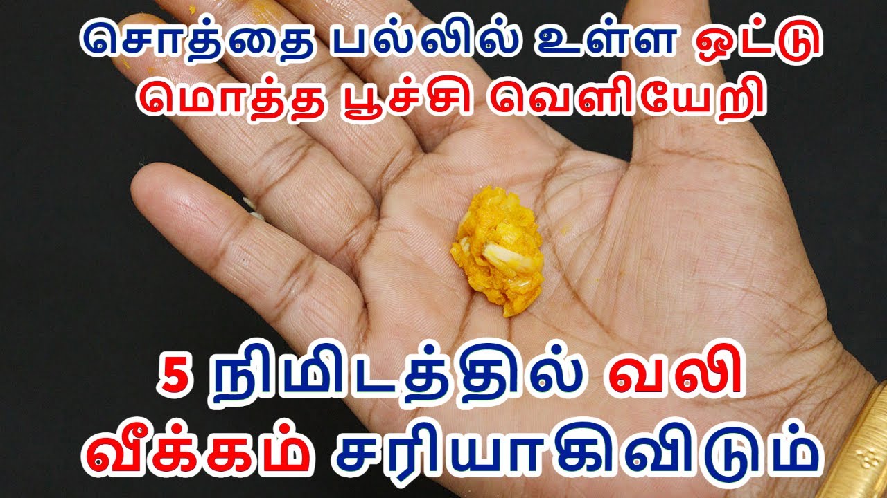 5 நிமிடத்தில் சொத்தை பல்லில் உள்ள பூச்சி வெளியேறி வலி சரியாகிவிடும் Sothai Pal sairyaga | cavity