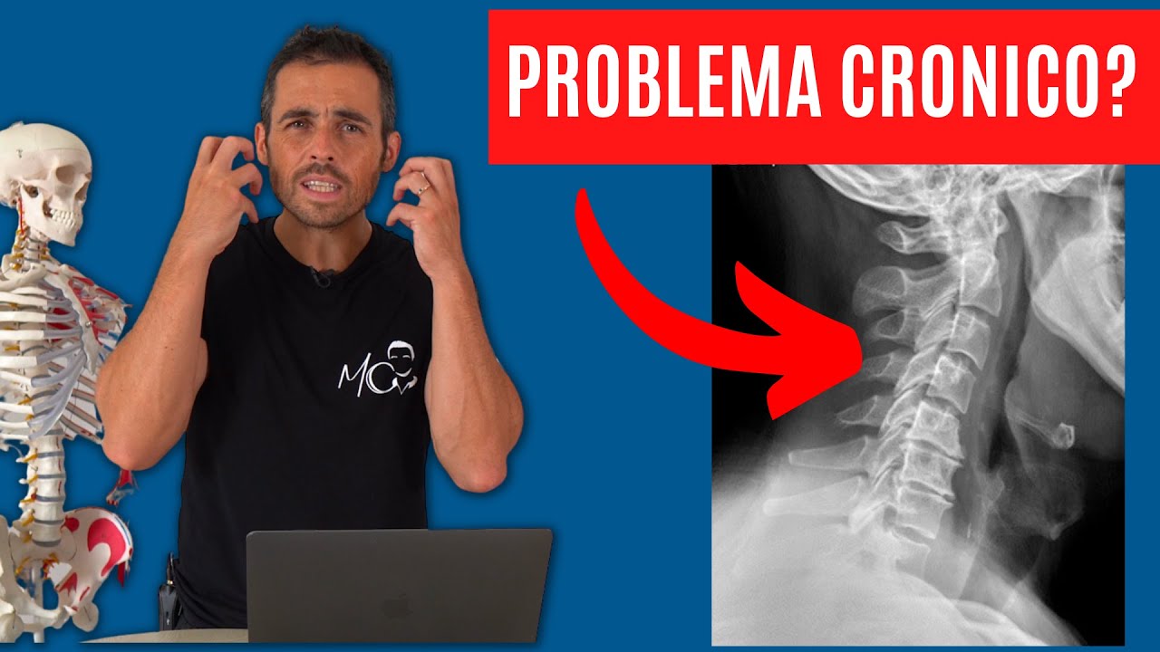 Come sconfiggere l'ARTROSI CERVICALE: migliorare si può!
