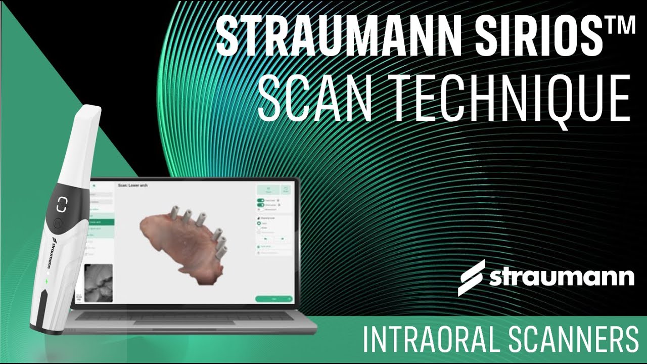 SIRIOS Scan Technique