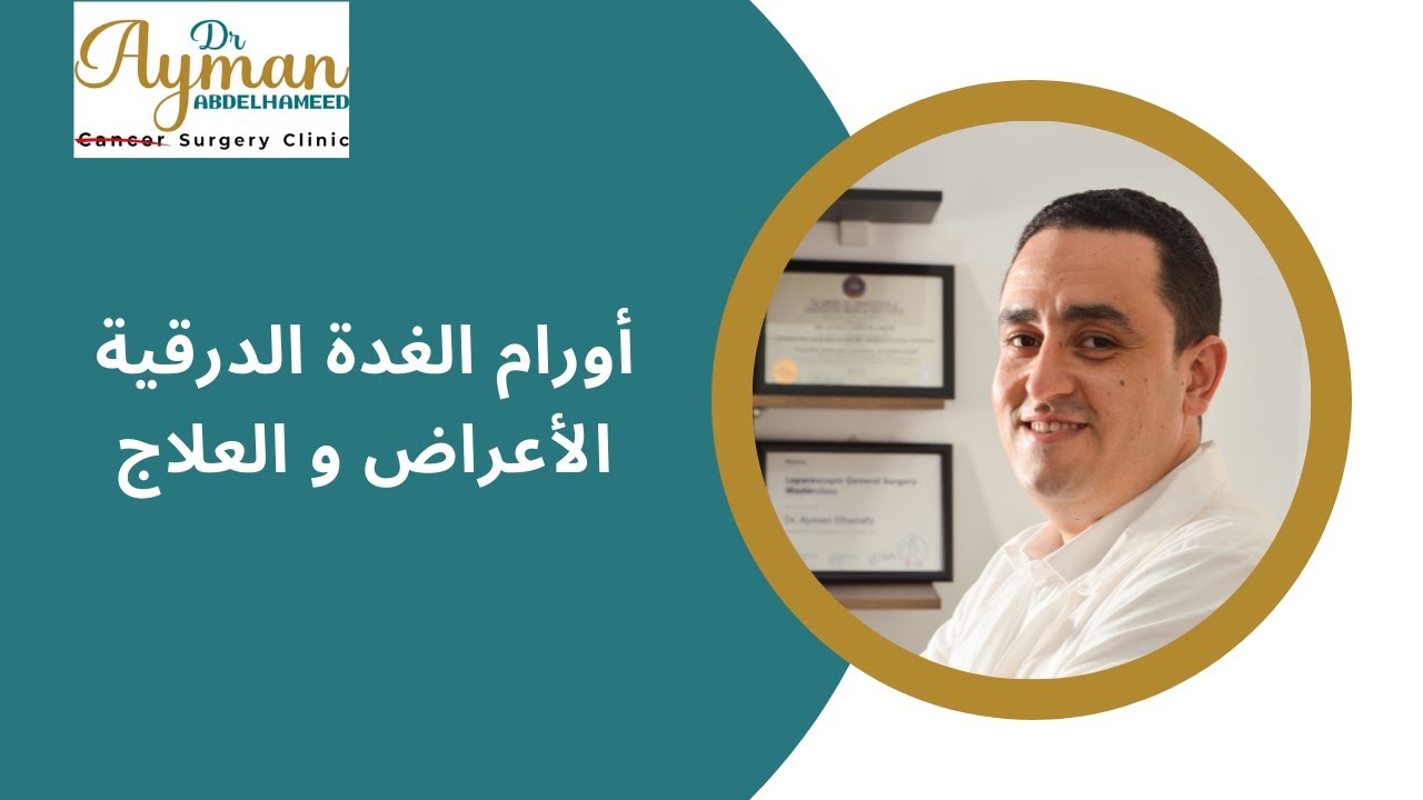 أورام الغدة الدرقية والأعراض والعلاج