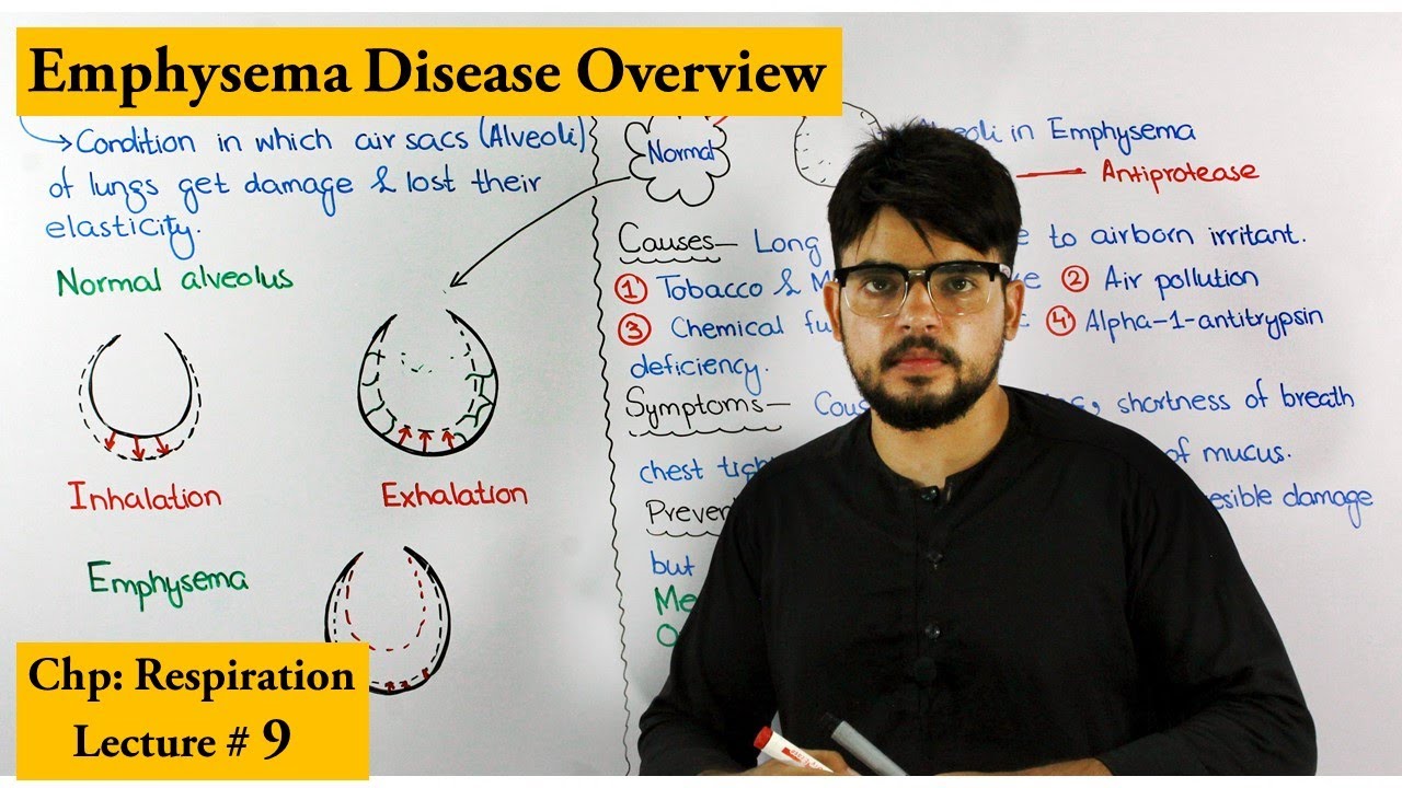 Emphysema | A Respiratory Disorder | Causes, Symptoms and Treatment
