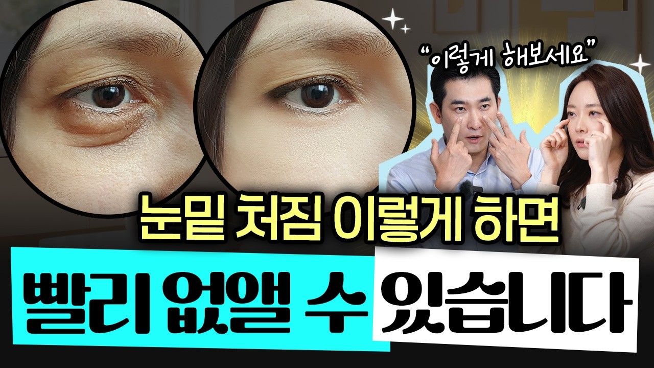 집에서 여기 눌러보세요! 눈밑 처짐 '이 방법'으로 10분 만에 해결됩니다🔥- 권수현 김종식 피부과 전문의