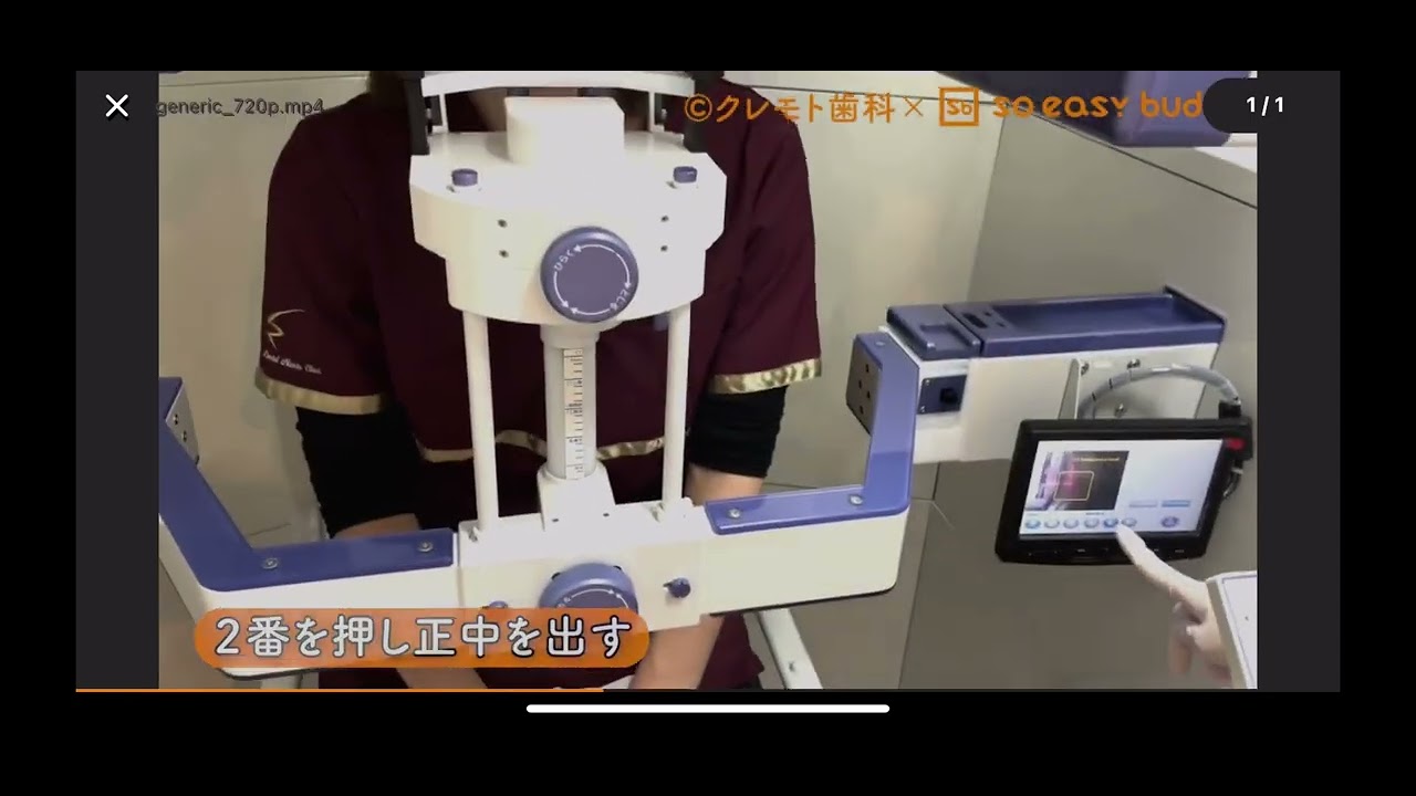 CT撮影方法
