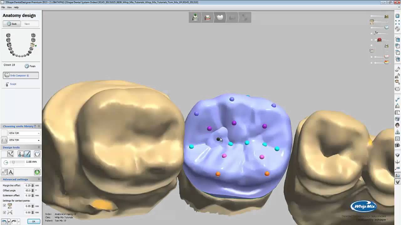 Учебное пособие 3Shape — проектирование анатомического колпачка в Dental Designer