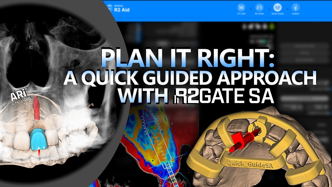 R2GateSA Tutorial Series | Clinical 4 : Quick Guide and R2One2