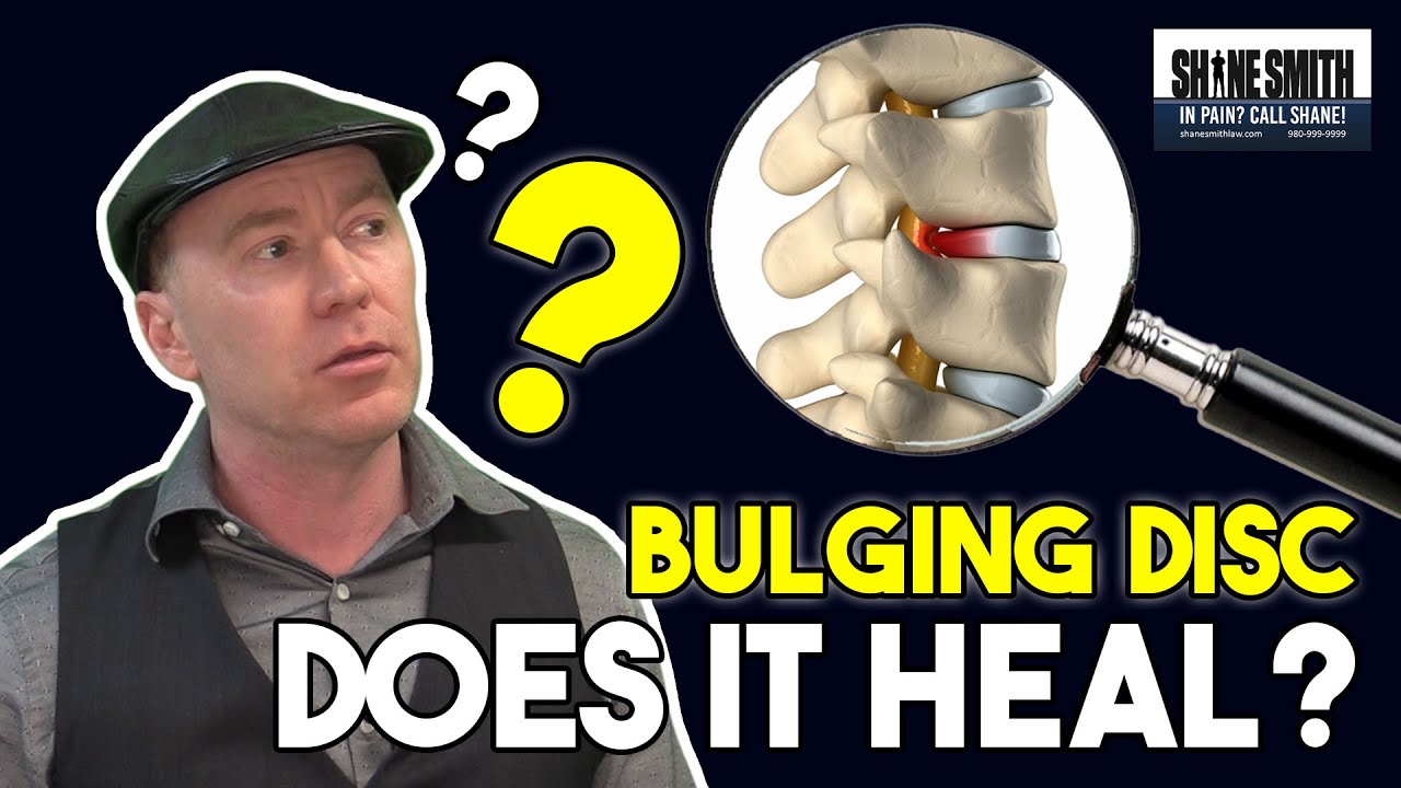 FAQ: Does a bulging disc heal? In Pain? Call Shane!