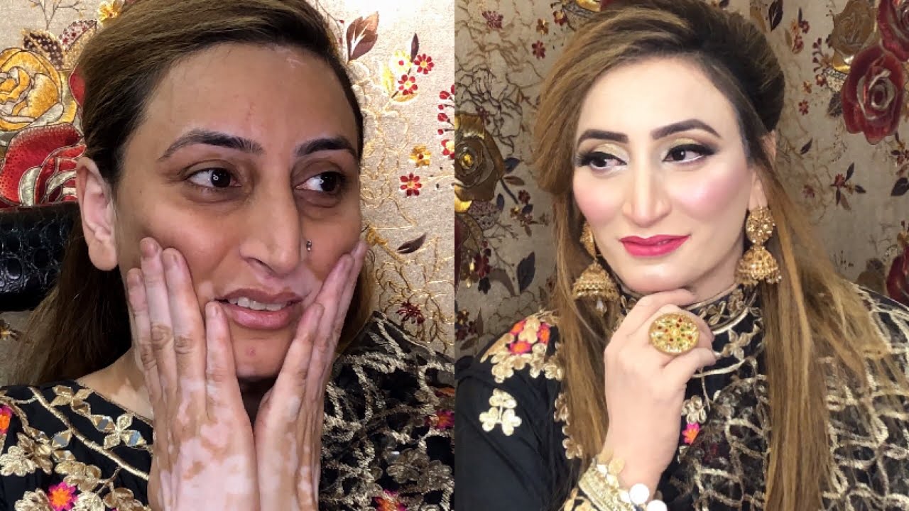 Makeup transformation 😱 How to makeup on white spots skin || Blush with Amna