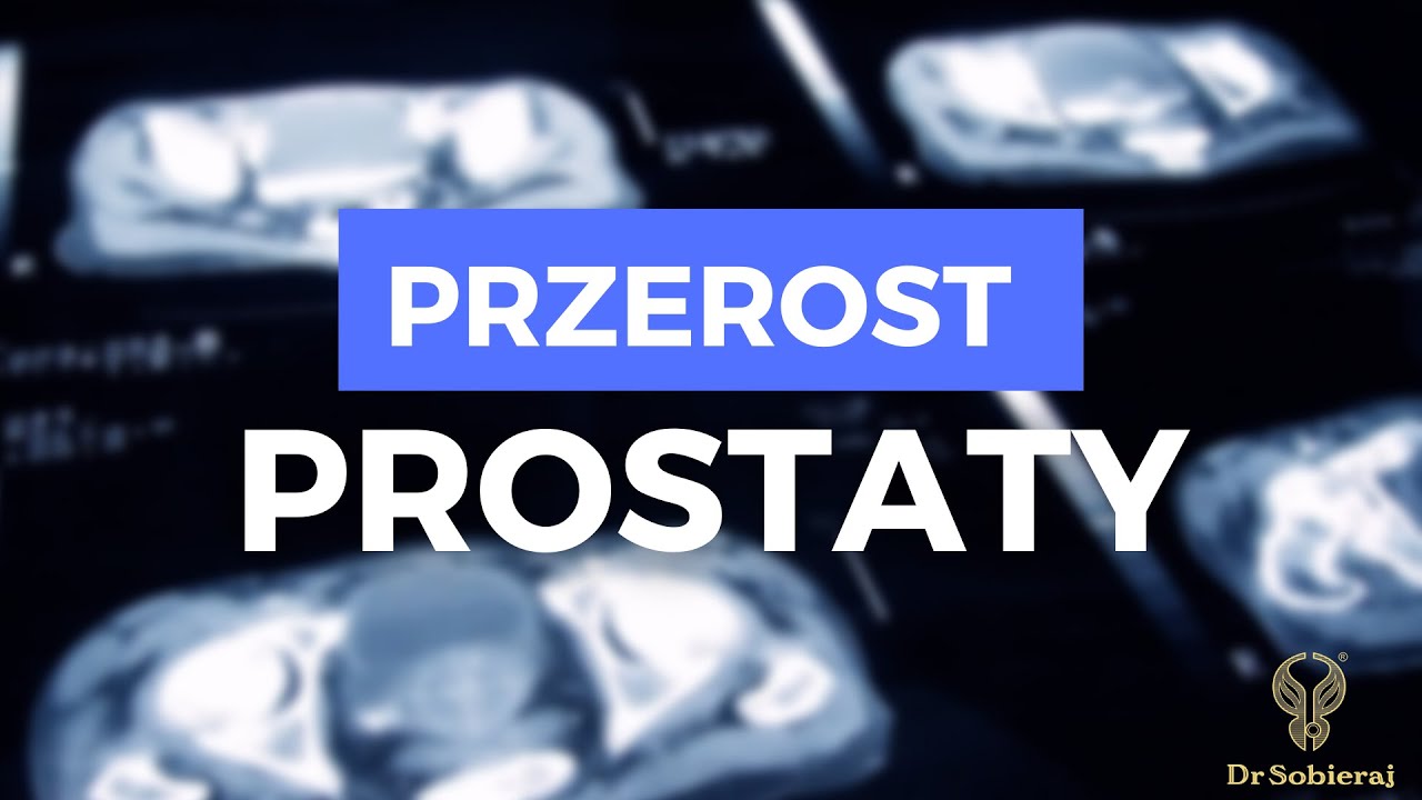 Przerost prostaty