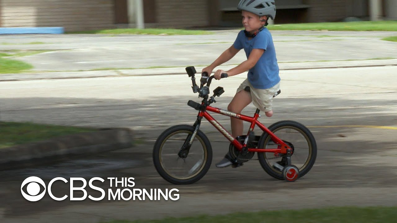 Teen Robotics Team's invention helps boy with a prosthetic leg ride a bicycle