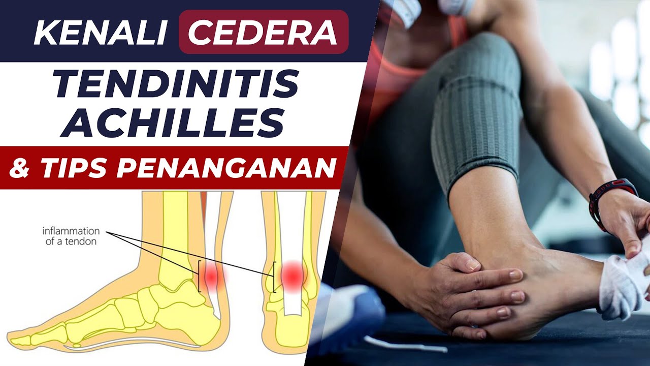 CEDERA ACHILLES - Kenali Tendinitis Achilles & Tips Penanganannya | Fisioterapi | First Physio
