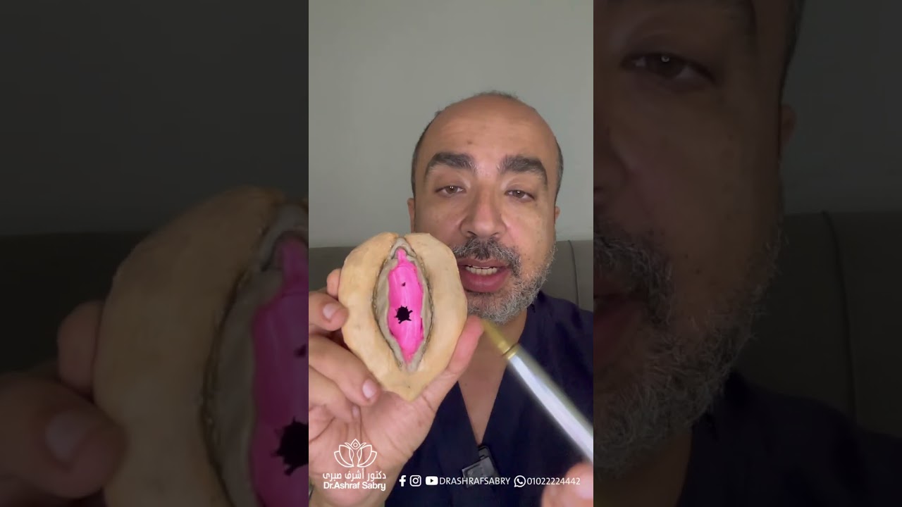 غشاء البكاره   #دكتور_أشرف_صبري #