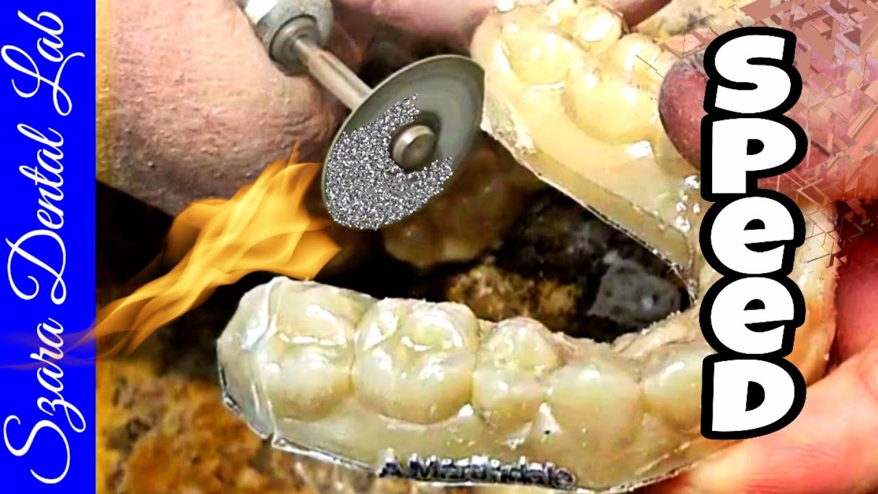 How to Finish Clear Retainers 3 tips Part 2 by Szara Dental