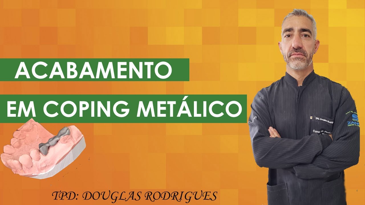 ACABAMENTO EM COPING METÁLICO