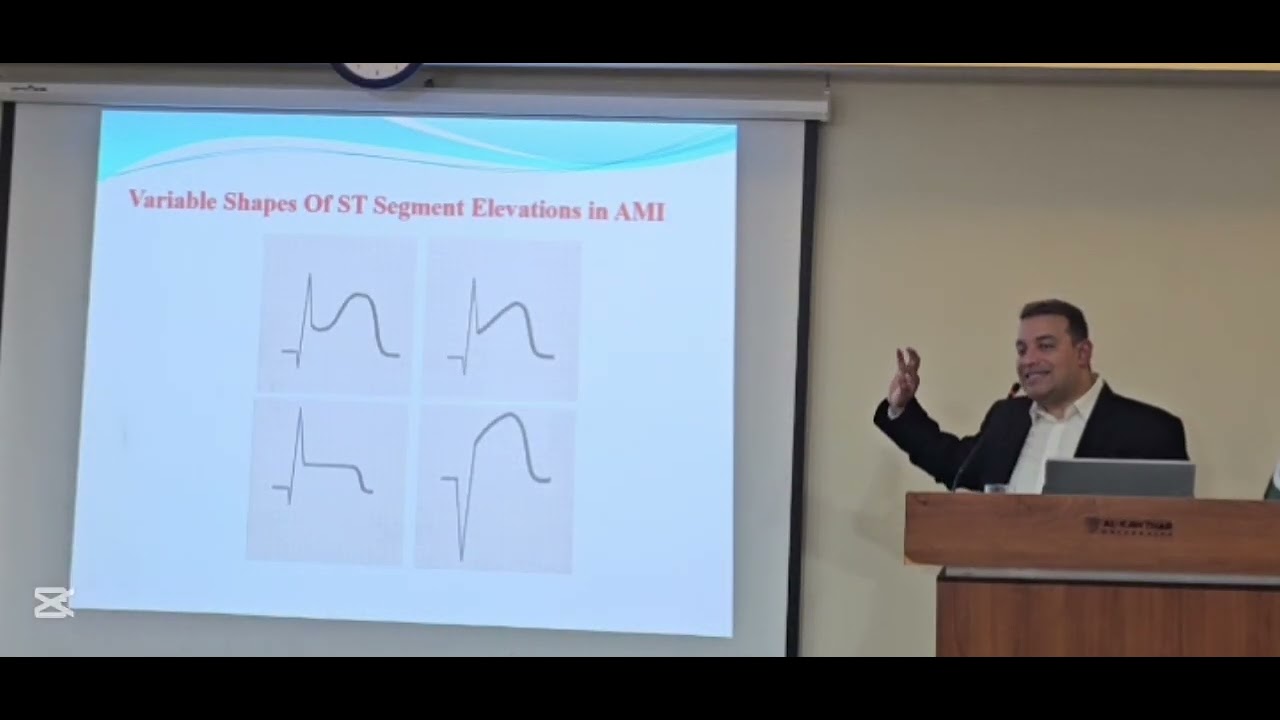 ECG WORKSHOP PART 2 OCTOBER 2025