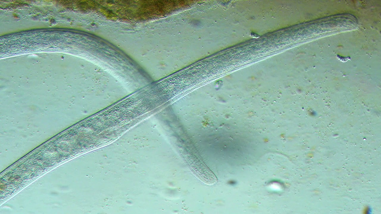 Ciliate: Spirostomum minus