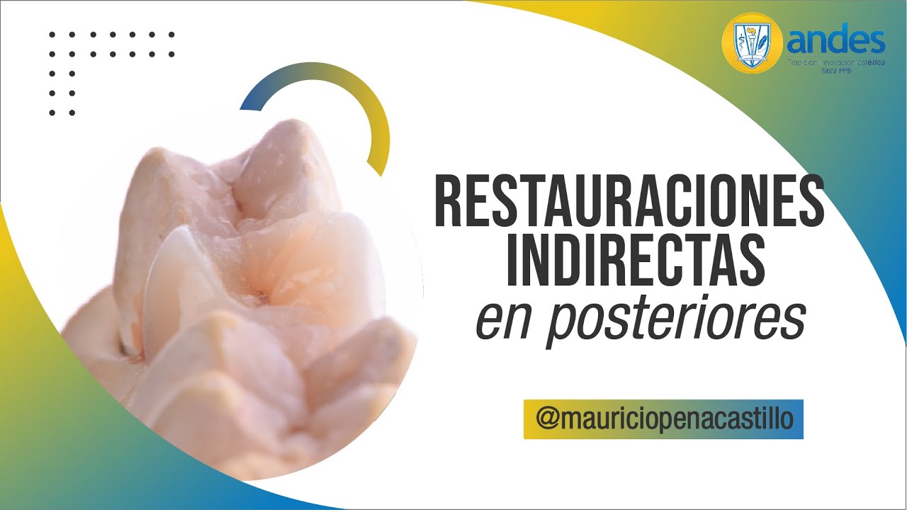 Restauraciones Indirectas en Posteriores I ANDES DTC