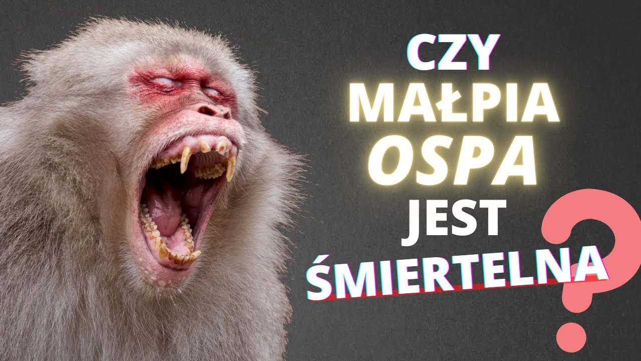 Straszą MAŁPIĄ OSPĄ - czy jest śmiertelna?