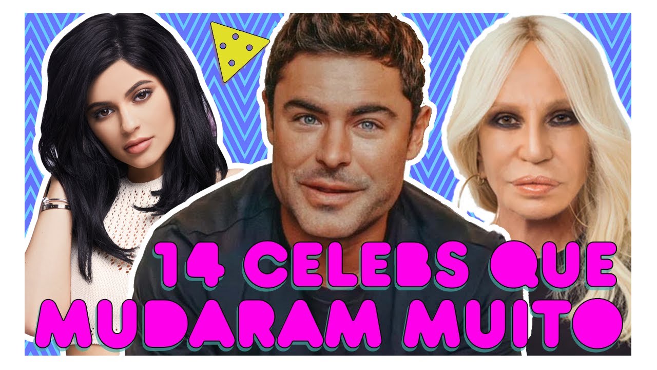 CELEBS QUE PROVAM QUE NEM SEMPRE PLÁSTICAS  SÃO A MELHOR OPÇÃO
