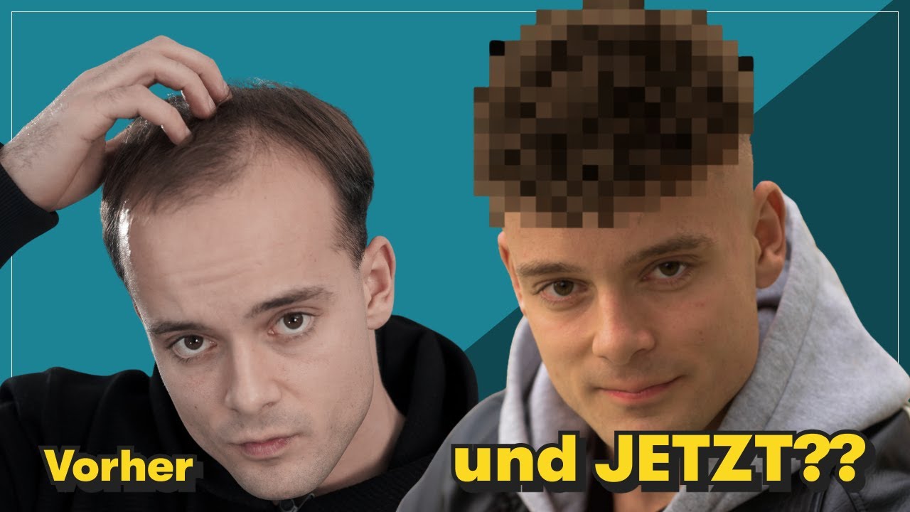 Transformation mit Haarsystem – plötzlich ein ganz anderer Typ?!