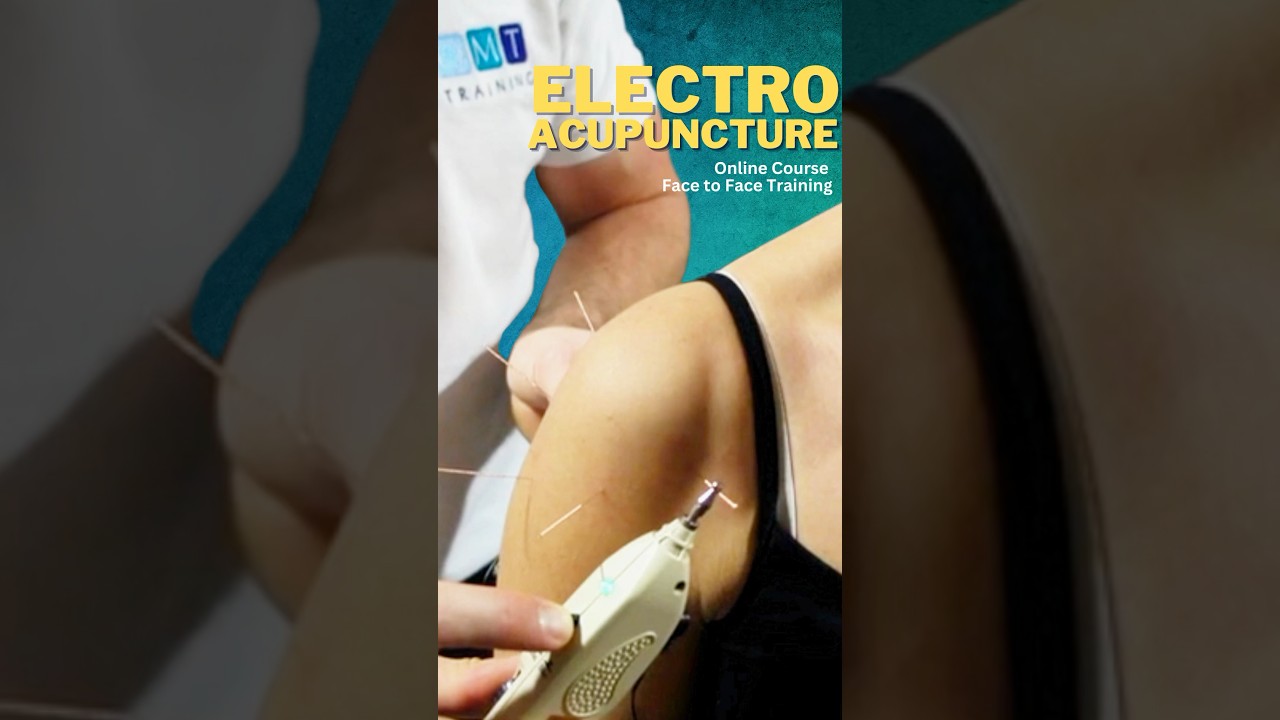 How does Electro Acupuncture works? #acupuncture #osteopathy #manualtherapy #shorts