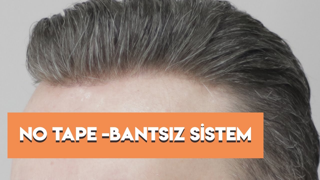 Protez Saç - No Tape - Bantsız Sistem - Hair Replacement