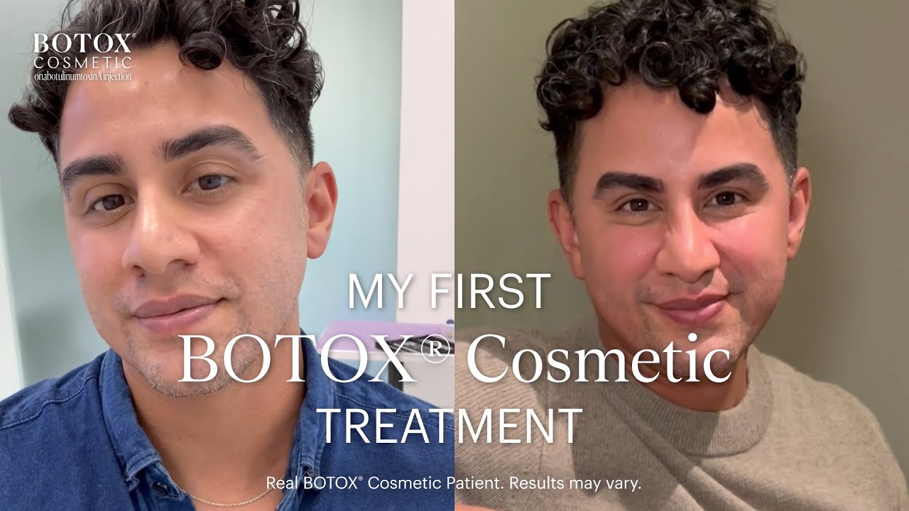First Time Getting BOTOX&reg; Cosmetic: Jeffrey Opens Up About the Experience