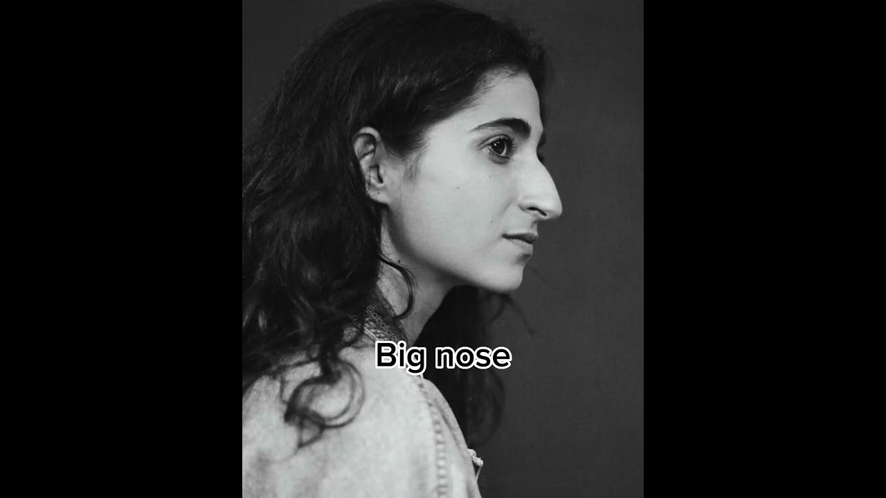 Big nose: Ugly facial features that is actually attractive